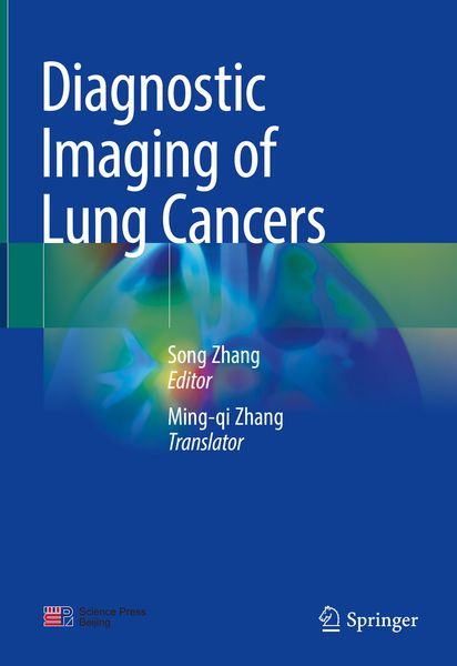 Produktbild: Diagnostic Imaging of Lung Cancers