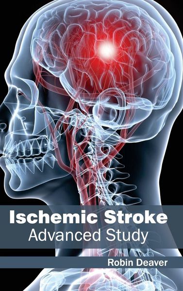 Produktbild: Ischemic Stroke