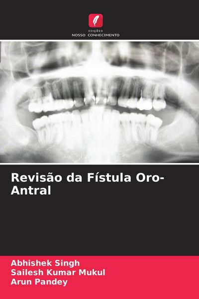 Produktbild: Revis&atilde;o da F&iacute;stula Oro-Antral