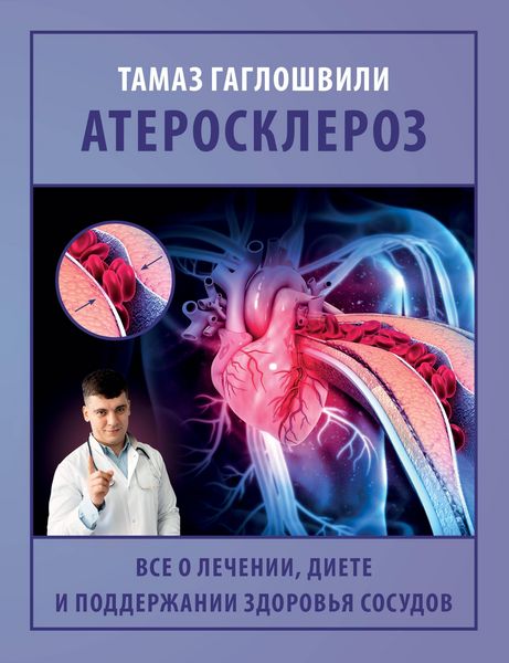 Produktbild: Ateroskleroz. Vse o lechenii, diete i podderzhanii zdorovya sosudov