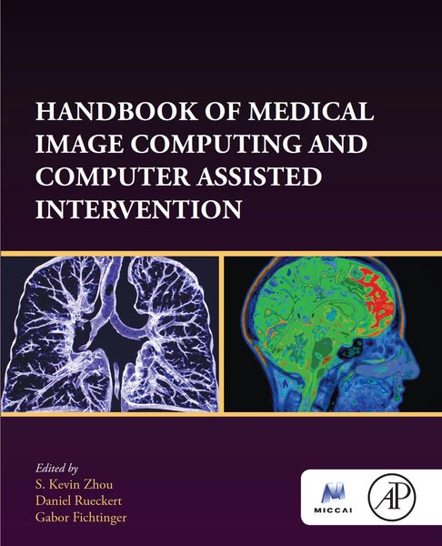 Produktbild: Handbook of Medical Image Computing and Computer Assisted Intervention