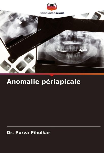 Produktbild: Anomalie p&eacute;riapicale