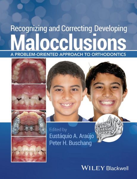 Produktbild: Recognizing and Correcting Developing Malocclusions
