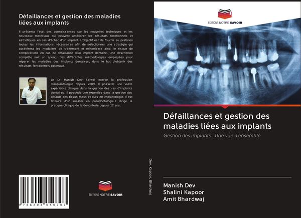 Produktbild: D&eacute;faillances et gestion des maladies li&eacute;es aux implants