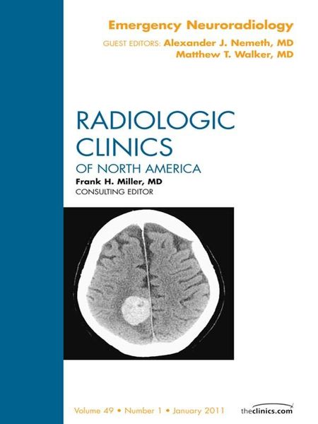Produktbild: Emergency Neuroradiology, An Issue of Radiologic Clinics of North America