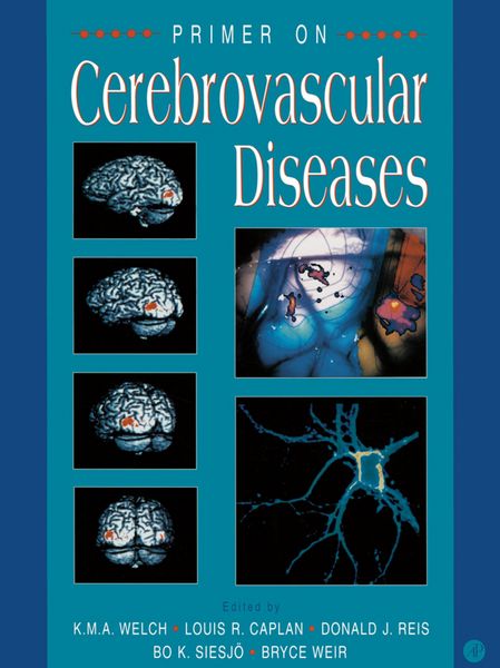 Produktbild: Primer on Cerebrovascular Diseases