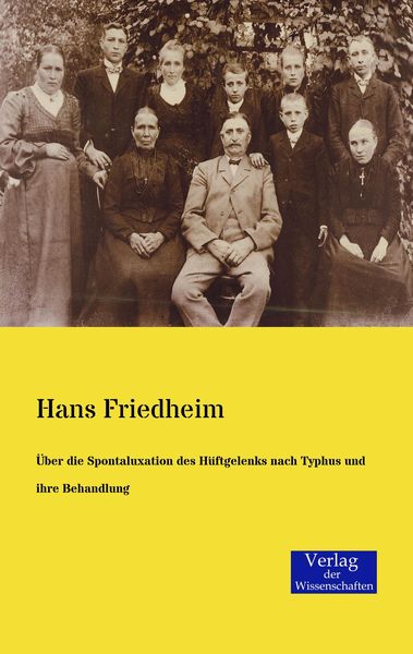 Produktbild: &Uuml;ber die Spontaluxation des H&uuml;ftgelenks nach Typhus und ihre Behandlung
