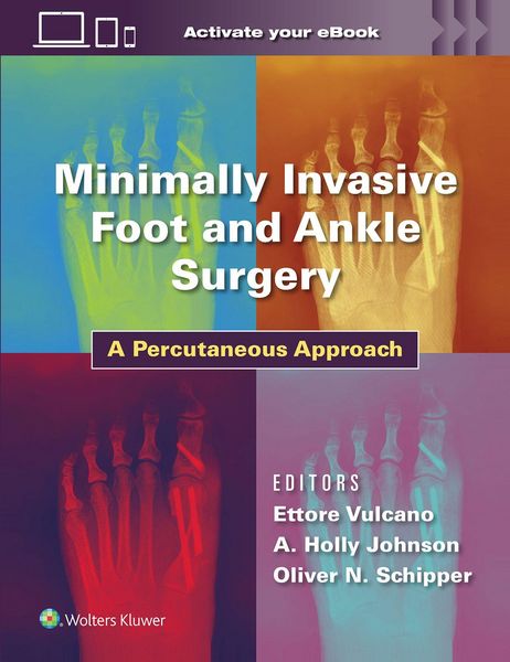 Produktbild: Minimally Invasive Foot and Ankle Surgery