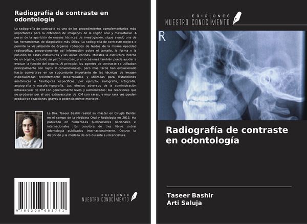 Produktbild: Radiograf&iacute;a de contraste en odontolog&iacute;a
