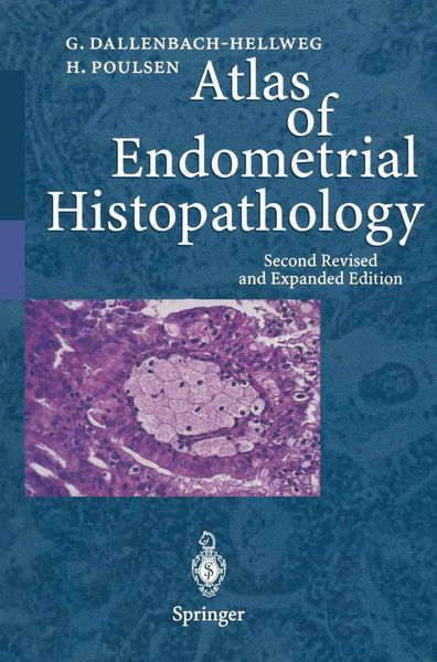 Produktbild: Atlas of Endometrial Histopathology
