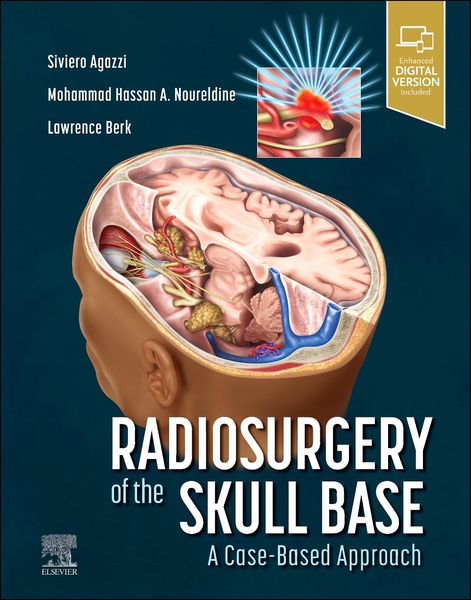Produktbild: Radiosurgery of the Skull Base: A Case-Based Approach