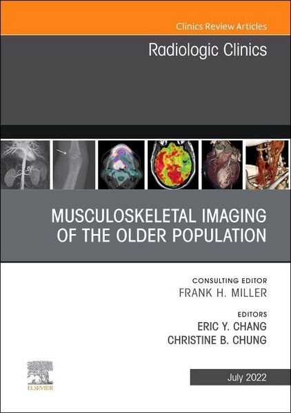 Produktbild: Musculoskeletal Imaging of the Older Population, an Issue of Radiologic Clinics of North America