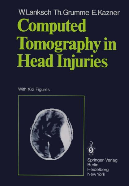 Produktbild: Computed Tomography in Head Injuries