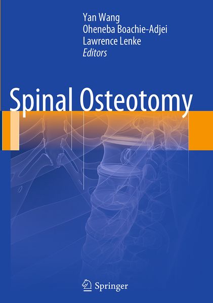 Produktbild: Spinal Osteotomy