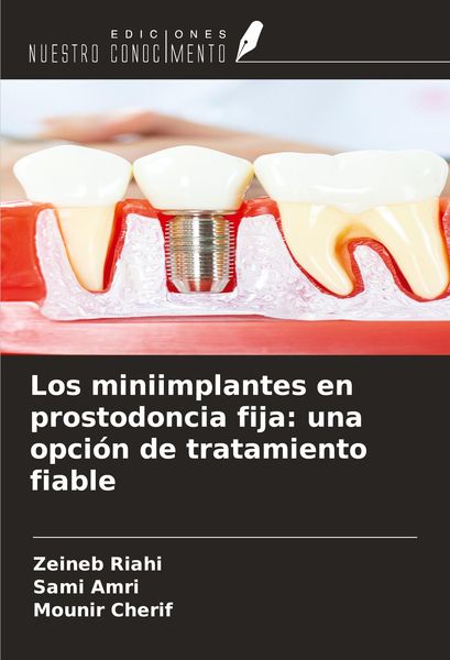 Produktbild: Los miniimplantes en prostodoncia fija: una opci&oacute;n de tratamiento fiable