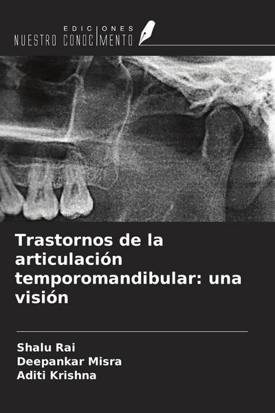Produktbild: Trastornos de la articulaci&oacute;n temporomandibular: una visi&oacute;n