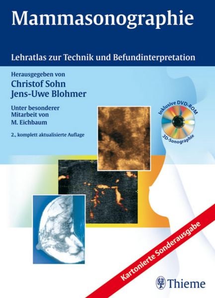 Produktbild: Mammasonographie