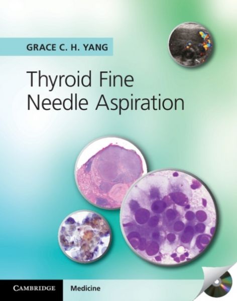 Produktbild: Thyroid Fine Needle Aspiration