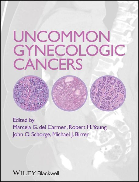 Produktbild: Uncommon Gynecologic Cancers