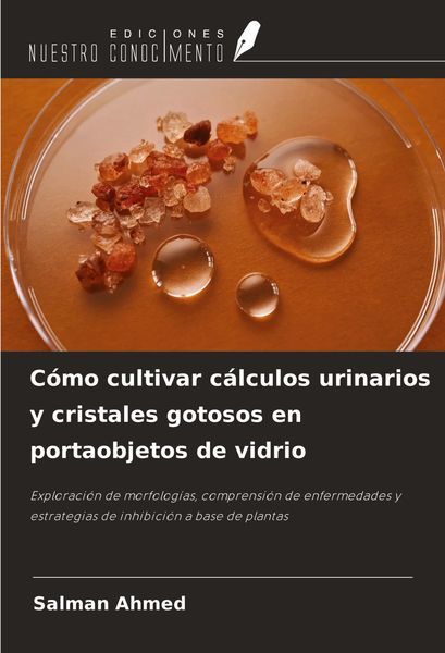 Produktbild: C&oacute;mo cultivar c&aacute;lculos urinarios y cristales gotosos en portaobjetos de vidrio