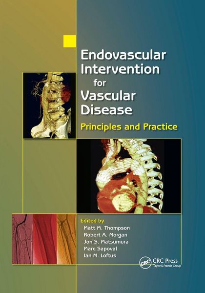 Produktbild: Endovascular Intervention for Vascular Disease