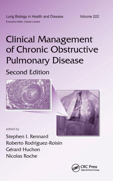 Produktbild: Clinical Management of Chronic Obstructive Pulmonary Disease