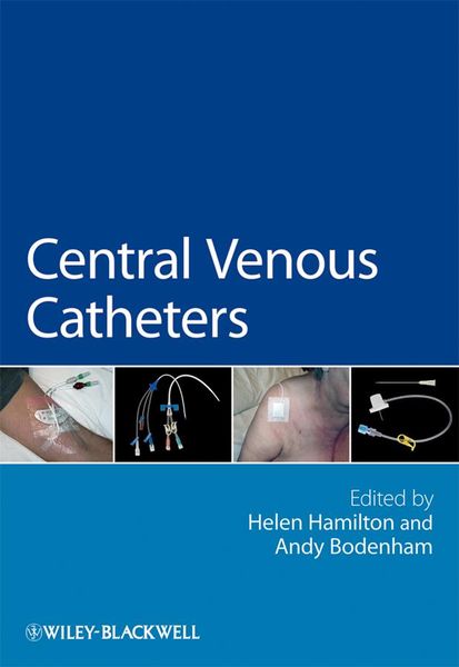 Produktbild: Central Venous Catheters