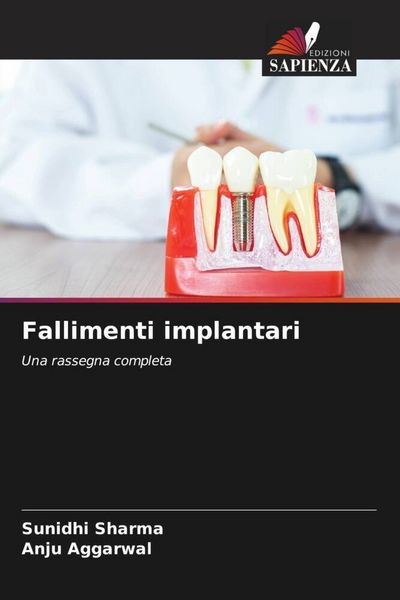 Produktbild: Fallimenti implantari