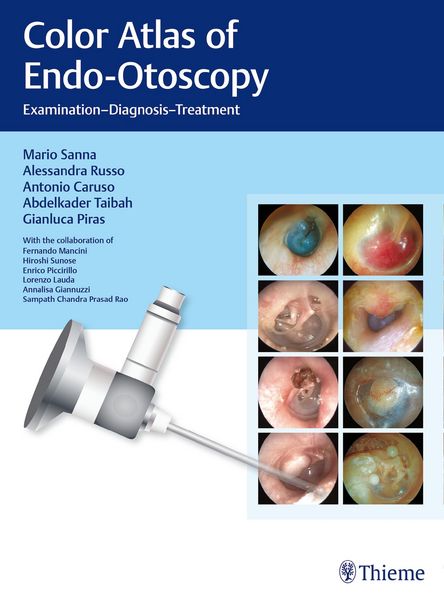 Produktbild: Color Atlas of Endo-Otoscopy