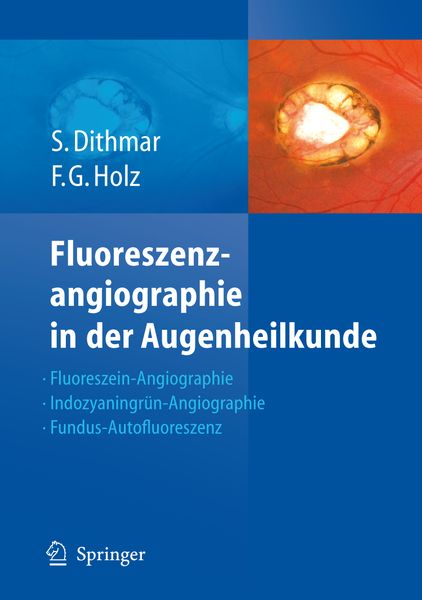Produktbild: Fluoreszenzangiographie in der Augenheilkunde