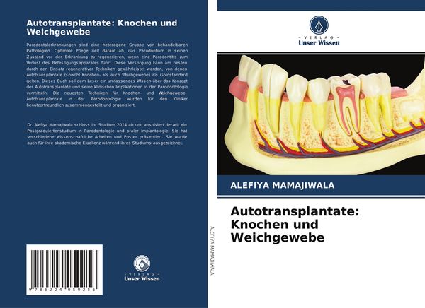 Produktbild: Autotransplantate: Knochen und Weichgewebe
