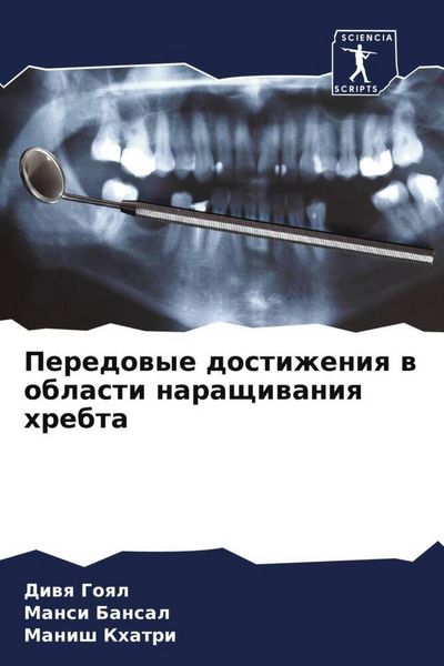 Produktbild: Peredowye dostizheniq w oblasti naraschiwaniq hrebta