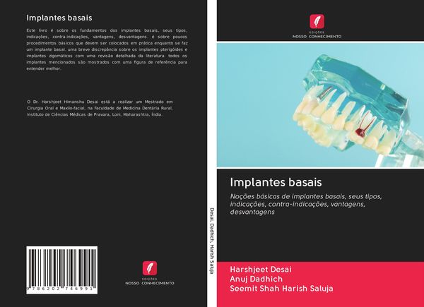 Produktbild: Implantes basais