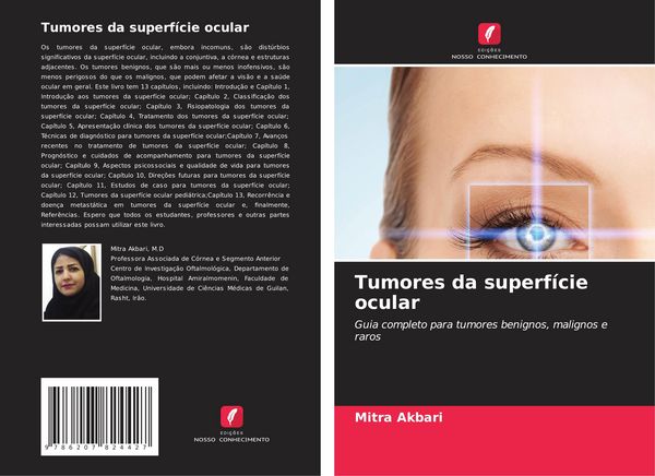 Produktbild: Tumores da superf&iacute;cie ocular