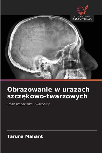 Produktbild: Obrazowanie w urazach szcz&iquest;kowo-twarzowych