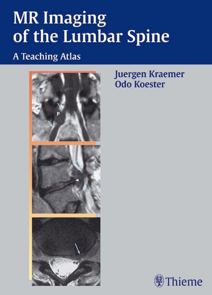 Produktbild: MR Imaging of the Lumbar Spine