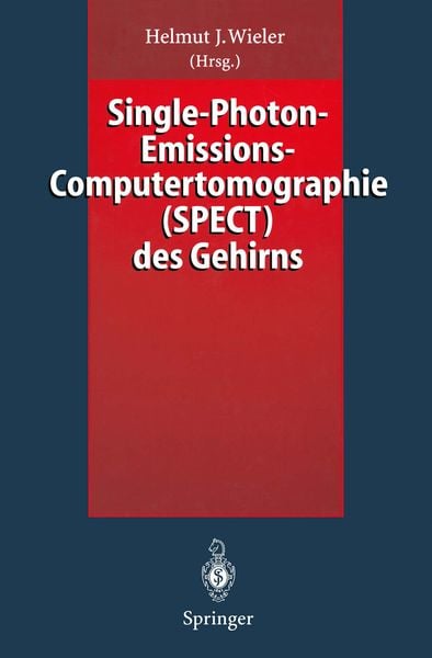 Produktbild: Single-Photon-Emissions-Computertomographie (SPECT) des Gehirns