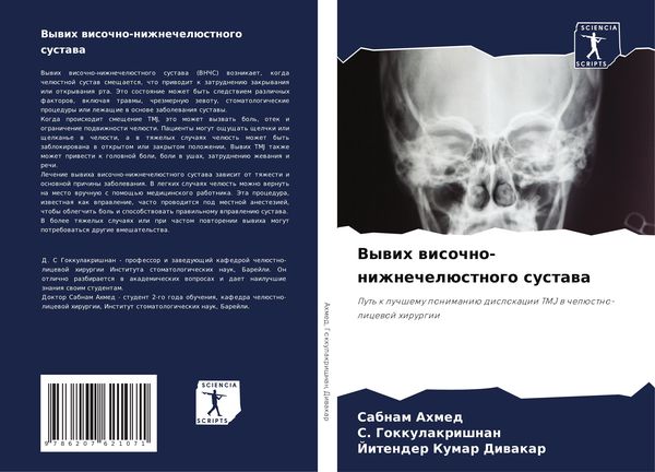 Produktbild: Vywih wisochno-nizhnechel&uuml;stnogo sustawa