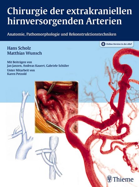 Produktbild: Chirurgie der extrakraniellen hirnversorgenden Arterien