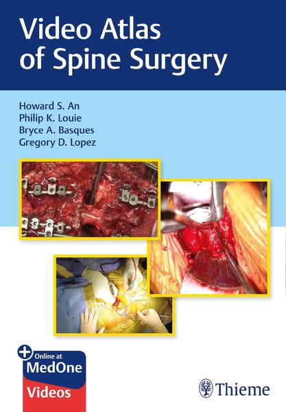 Produktbild: Video Atlas of Spine Surgery