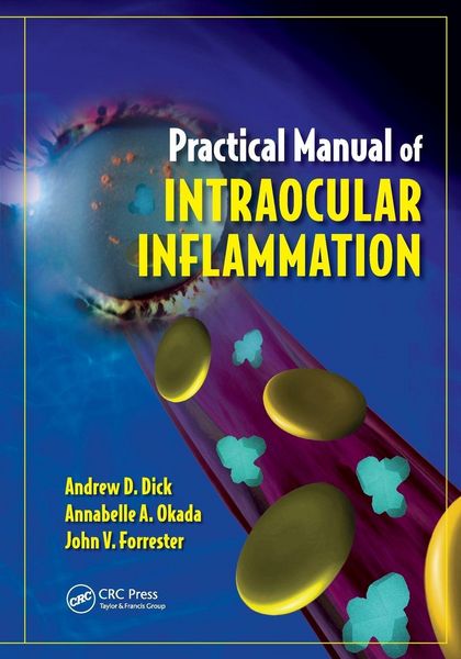 Produktbild: Practical Manual of Intraocular Inflammation
