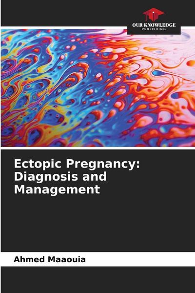 Produktbild: Ectopic Pregnancy: Diagnosis and Management