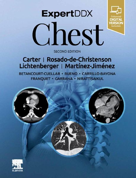 Produktbild: ExpertDDx: Chest