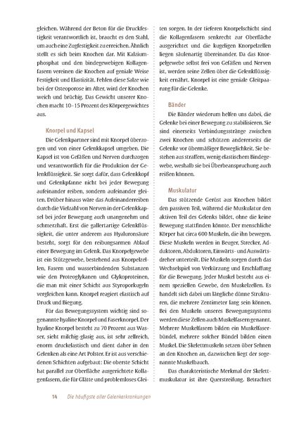 Produktbild: Expertenwissen: Arthrose