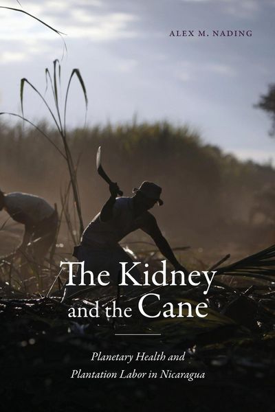 Produktbild: The Kidney and the Cane