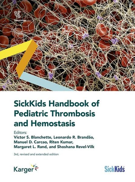 Produktbild: SickKids Handbook of Pediatric Thrombosis and Hemostasis