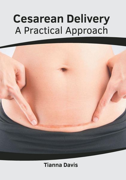 Produktbild: Cesarean Delivery: A Practical Approach
