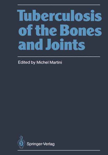 Produktbild: Tuberculosis of the Bones and Joints