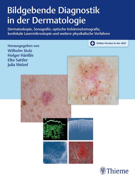 Produktbild: Bildgebende Diagnostik in der Dermatologie