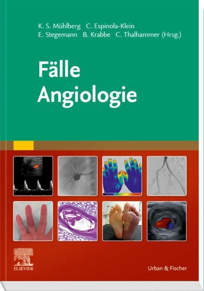 Produktbild: Fälle Angiologie